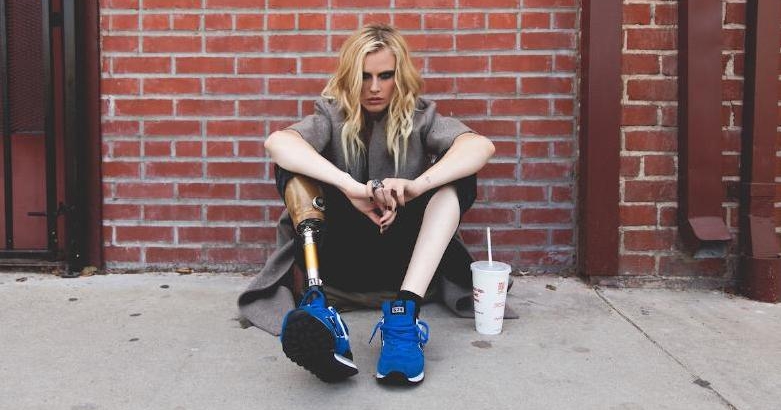 This Model Lost Her Leg After Using A Tampon. She Is Now Suing The