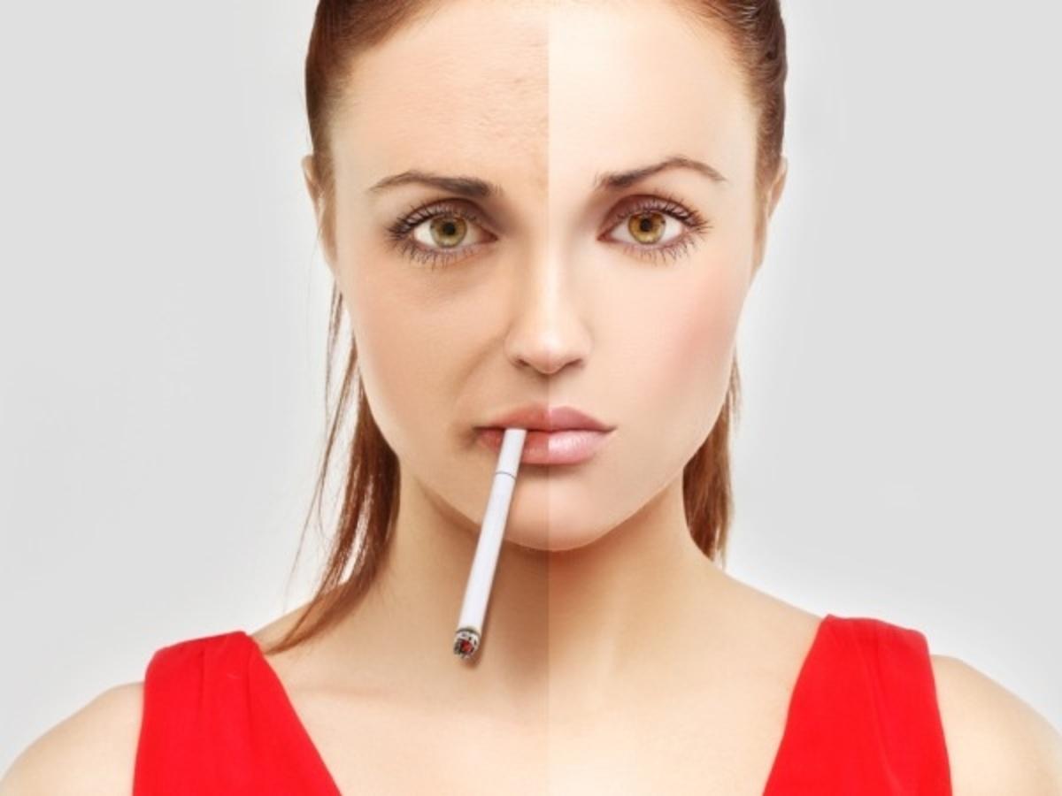 smoking effects on skin before and after
