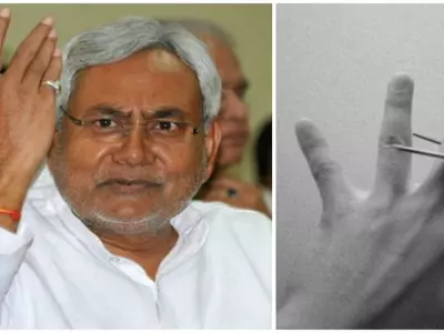 Man Chops Finger Over Nitish Kumar’s Win