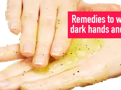Whiten Dark Hands Naturally Using Kitchen Ingredients!
