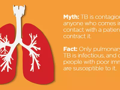 Myths About Tuberculosis