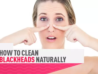 Really Effective Ways To Remove Blackheads On Face And Nose
