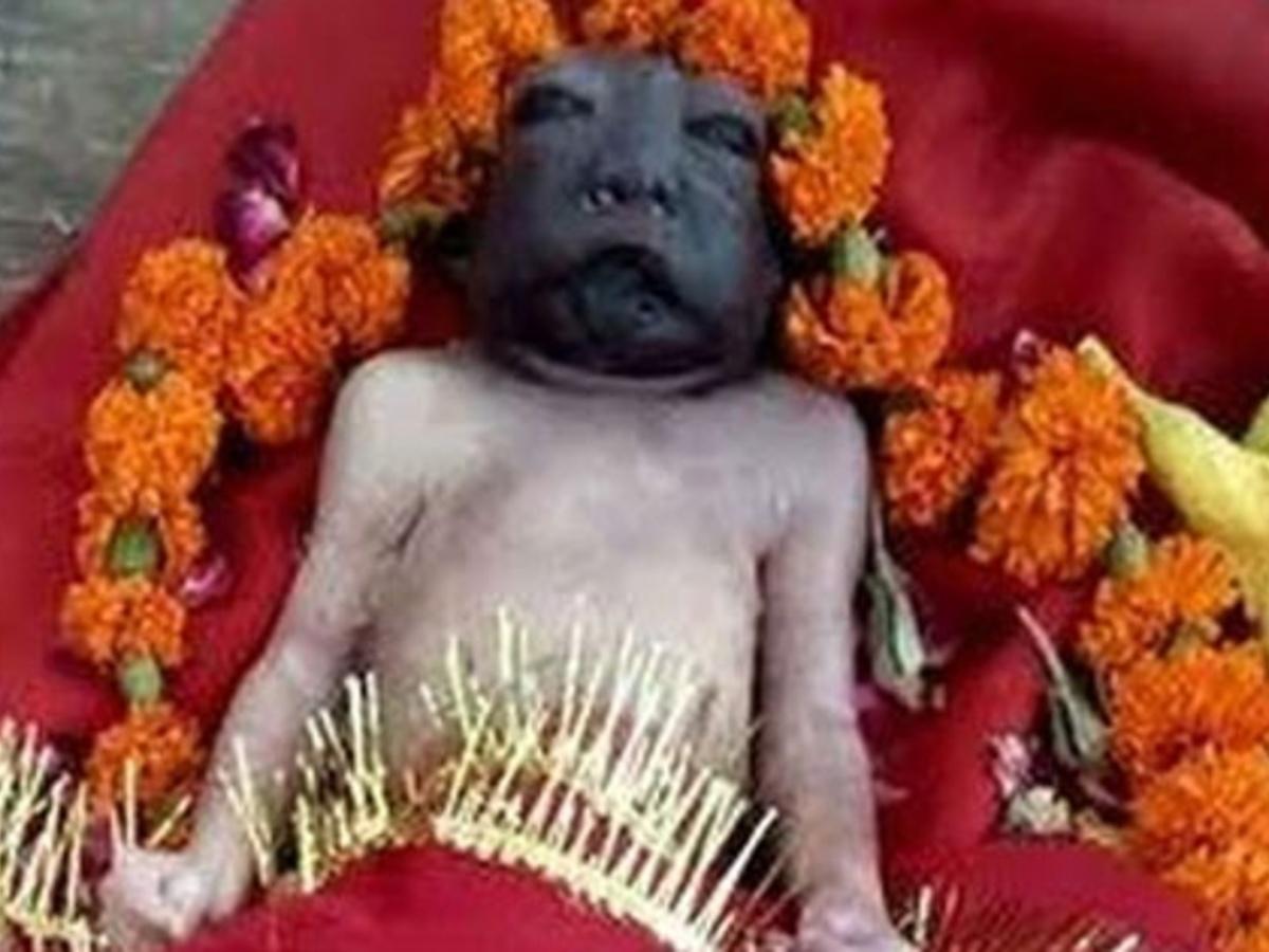 Only In India Are Kids With Birth Defects Worshipped As Gods
