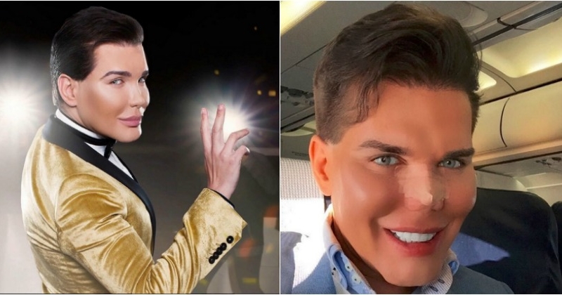 Meet Rodrigo Alves, A Plastic Surgery Addict Who Has Been Hospitalised ...