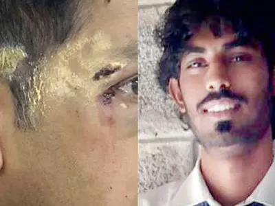 Army Officer Attacked By Bengaluru Locals In Road Rage For Being A 'North Indian'