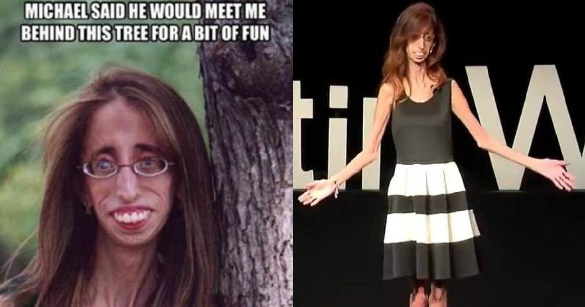 A TEDx Speaker Called Out The People Who Made Rude Memes Of Her In The ...