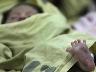 Two Hour Old Baby Found Near Mumbai Dustbin, Dogs Had Eaten Most Of His Body