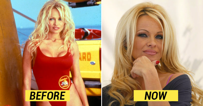 27 Years On, This Is What The Original Star Cast Of ‘Baywatch’ Looks Like!