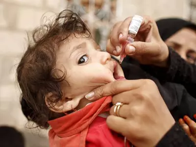 Polio Virus Resurfaces In Hyderabad After 5 Years