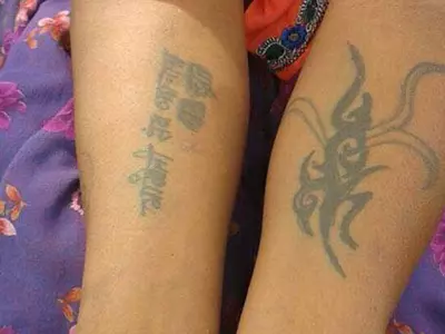 Her Husband And In-Laws Gangraped Her. Then She Was Tattooed With Abuses