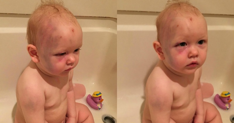 one-year-old-boy-gets-beaten-up-by-babysitter-parents-recieve-no