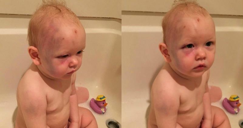 One Year Old Boy Gets Beaten Up By Babysitter Parents Recieve No 