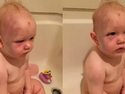 One-Year-Old Son Gets Beaten Up By Babysitter, Parents Recieve No Support From The Law