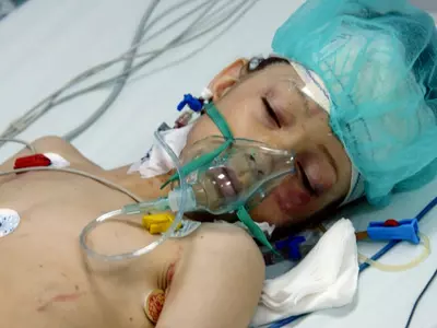 8 Year Old Boy Dies After Mistakenly Being Given Nitrous Oxide Instead Of Oxygen