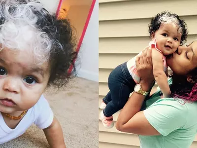 This Little Girl Was Born With The Exact Same Patch Of White Hair As Her Mom's!