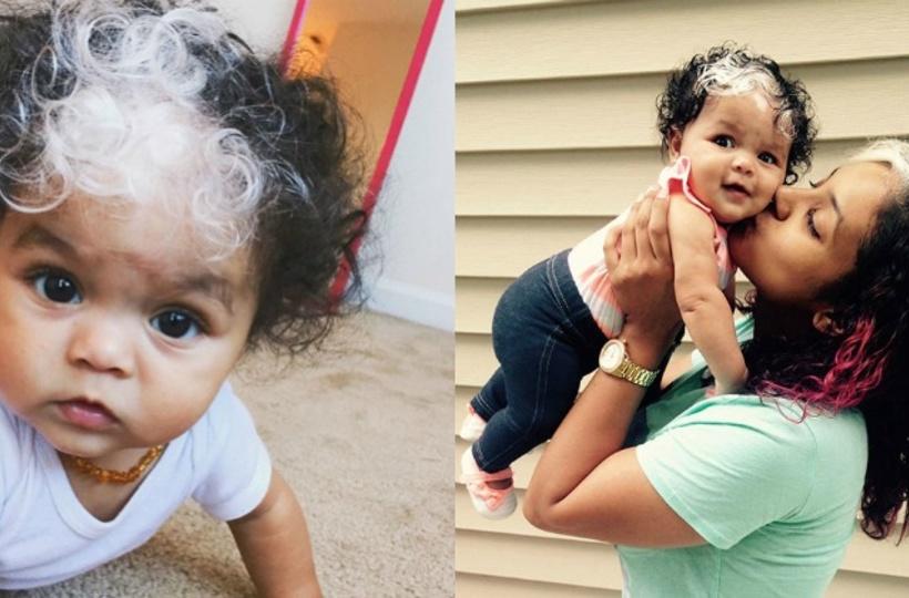 This Little Girl Was Born With The Exact Same Patch Of White Hair As Her  Mom!