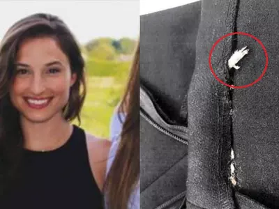 A Woman Is Suing Zara After She Found A Rotten Rodent's Leg Sewn Into The Dress She Bought!