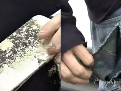 iPhone 6 Plus Burns A Hole In This Student's Back Pocket After Exploding!