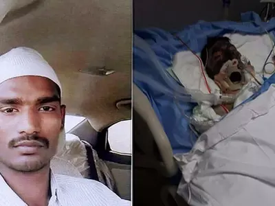 Hyderabad Man Burnt in Saudi
