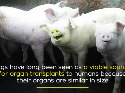 pigs organ donation for humans