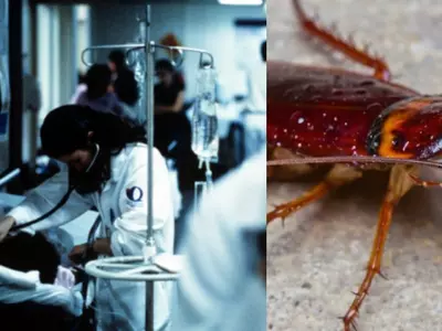 doctors remove live cockroach