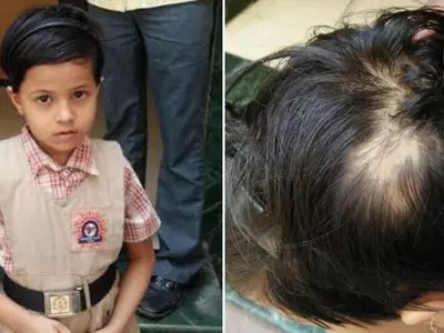 Teacher pulls out 6-yr-old's hair