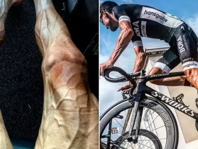 Cyclist shares freaky sight of his legs