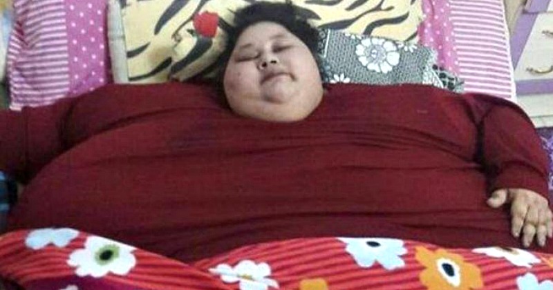 World's Heaviest Woman - Eman Ahmed Has Lost 140 Kilos Since She First ...