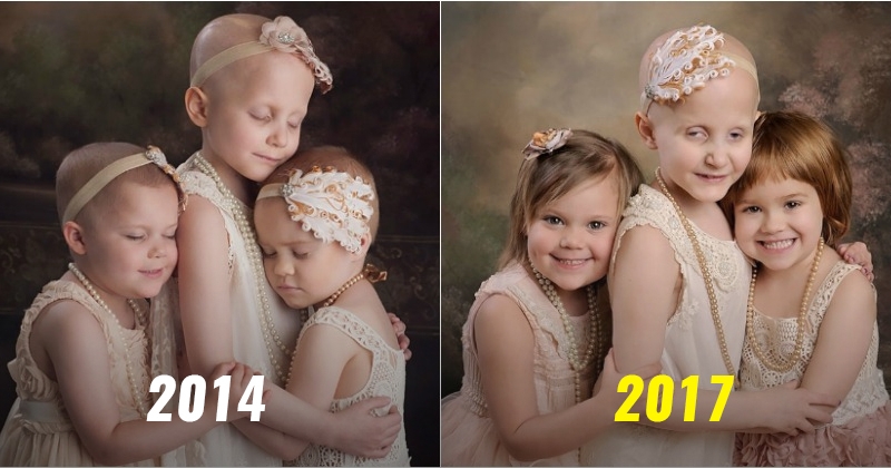 After Beating Cancer 3 Little Survivors Reunite To Recreate The Same Viral Photo From 2014