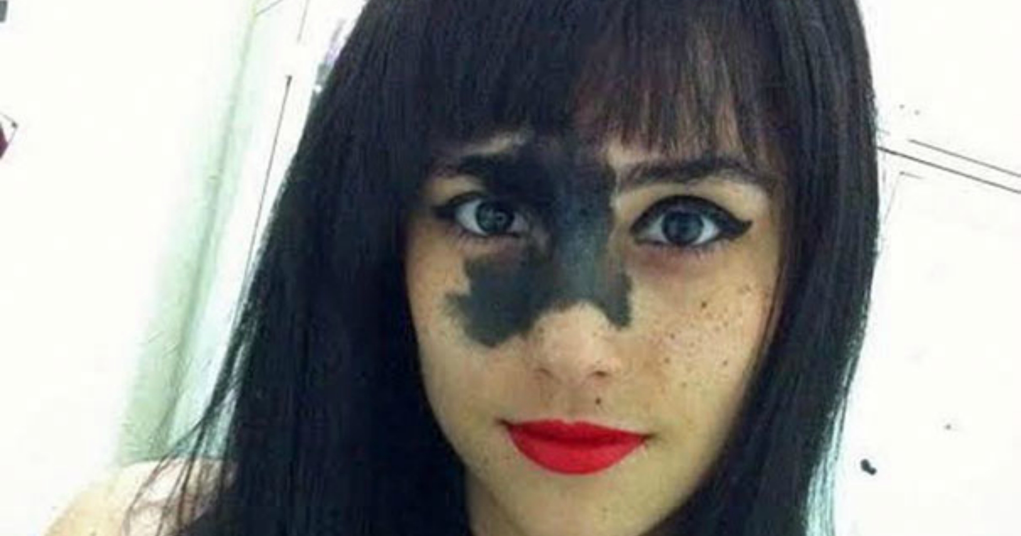 This Girls Rare Birthmark Looks Bizarre To People But She Proved That 