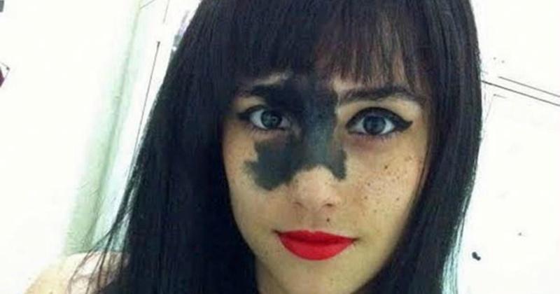 This Girls Rare Birthmark Looks Bizarre To People But She Proved That