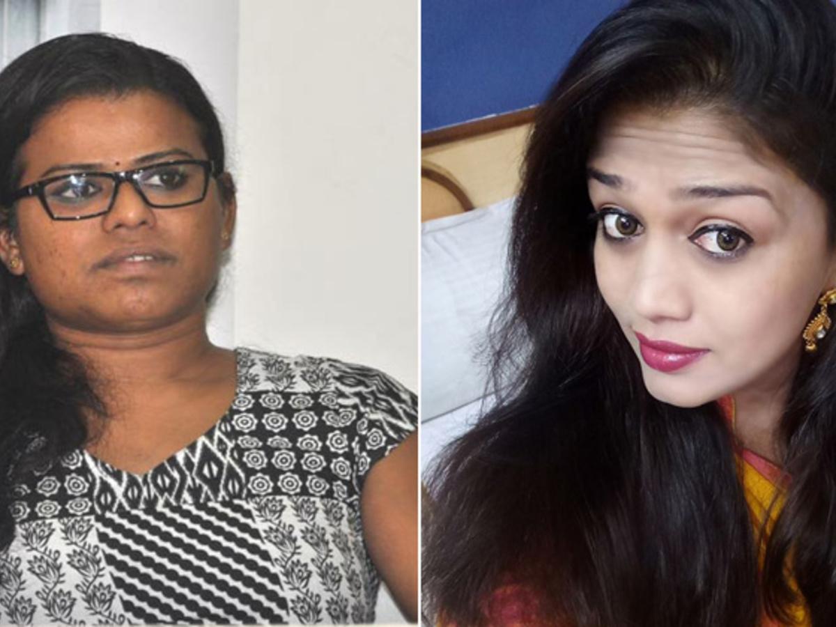 Men Changed Women Transformation Surgery