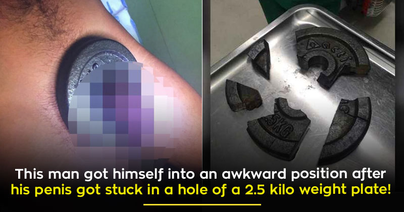 This Guy Got His Penis Stuck In A Weight Plate So Badly It Took Three