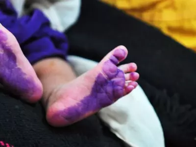 Newborn Dies After Fraudster Cuts Off Baby Genitals