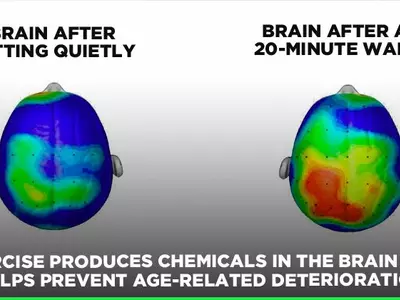 7 Incredible Benefits Exercise Has On The Health And Well-Being Of Your Brain