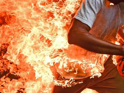 Man Sets Himself On Fire After Wife Refuses To Return Home
