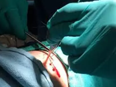 Sweeper Giving Stitches
