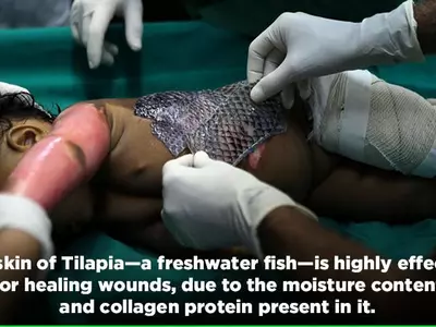 Fish Skin Is A Cheaper, Less Painful & A Faster Way Of Treating Burns Than Bandages