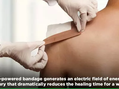 This Self-Healing E-Bandage Accelerates Wound Healing By Generating An Electric Field Over It