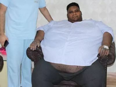 410kg Man Goes Under Scalpel Loses 30kg In A Month