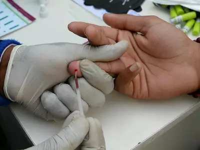 People Living With HIV AIDS To Get Free Viral Load Testing