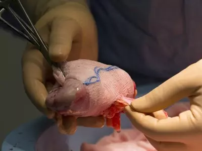 Family Donates Brain Dead Son Organs