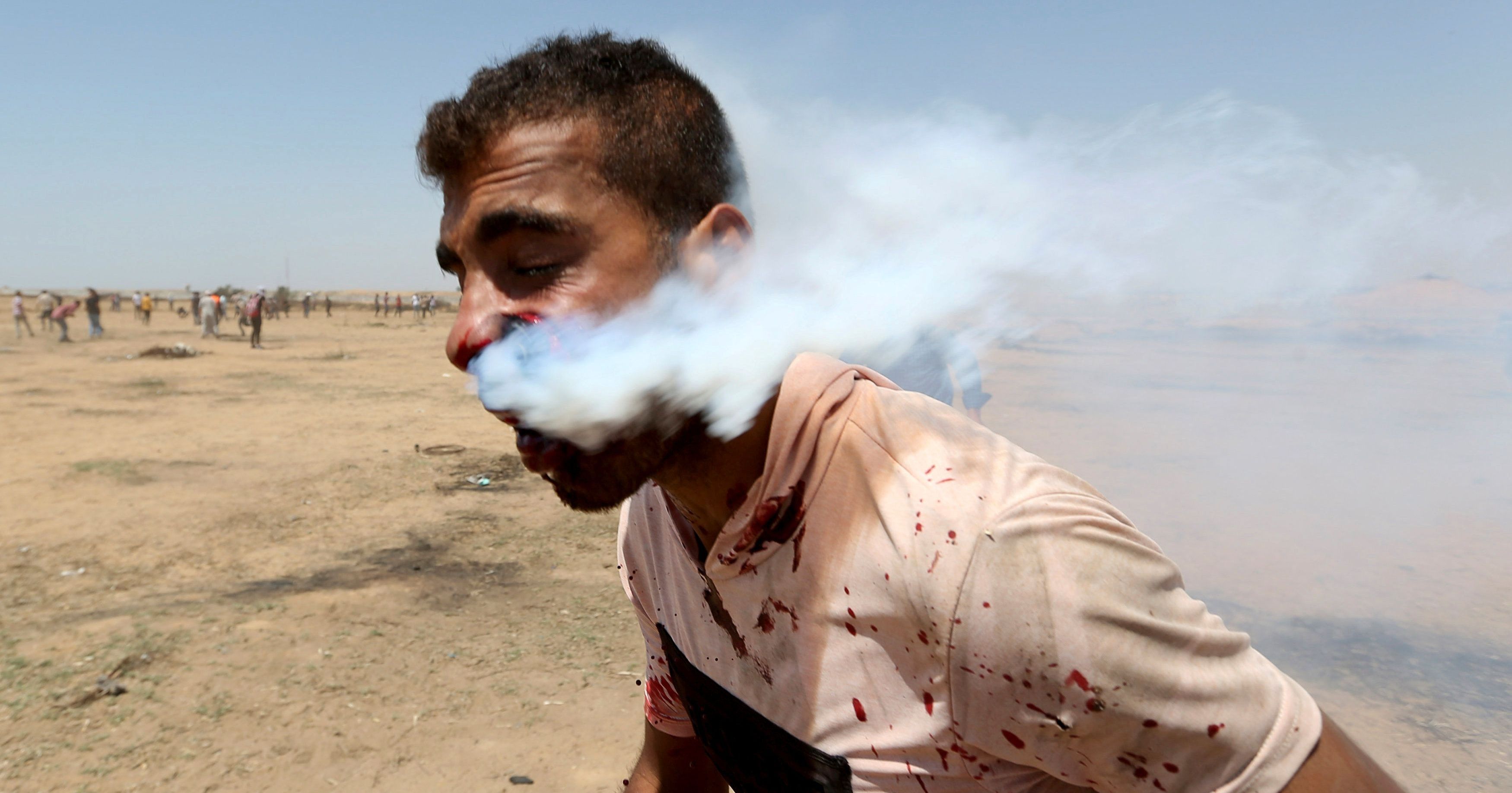 Tear Gas Canister Fired By Israeli Troops Hits Palestinian Man In The Face Put On Life Support