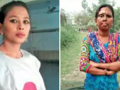 Kolkata Woman Fights For 4 Years Gets Acid Attacker Behind Bars