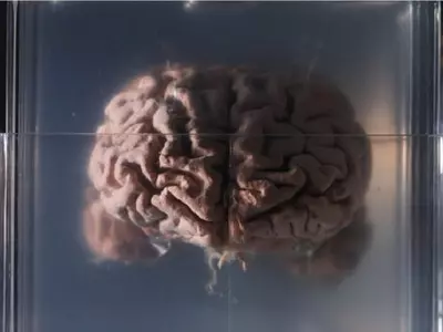 preserved brain