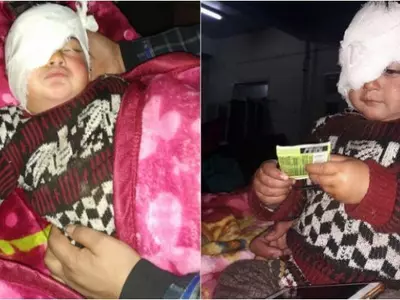 19-Month-Old Heeba Is The Youngest Victim Of Pellet Guns In Kashmir; May Lose Sight