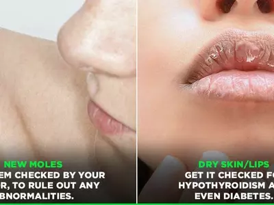 9 Symptoms On Your Face & Body That Could Be A Clear Indication That You Are Sick