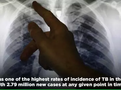 TB Remains To Be The World’s Deadliest Infectious Disease Says WHO, India Falls In The Top 20