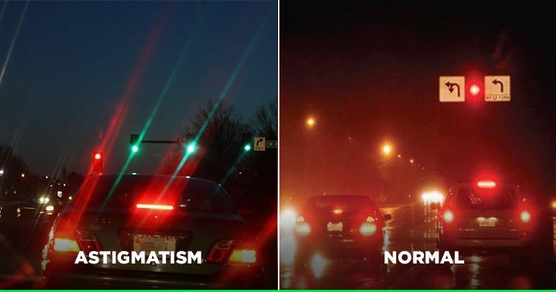 Why Post On How People With Astigmatism See Light Has Gone Viral