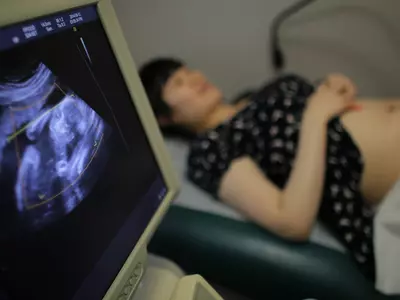 Abortion Caused 41 Million Deaths In 2018